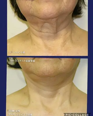 ﾌﾟﾗｲﾍﾞｰﾄｻﾛﾝ アンクチュール所属・UnCouture 〜アンクチュール〜のエステ・リラクイメージ