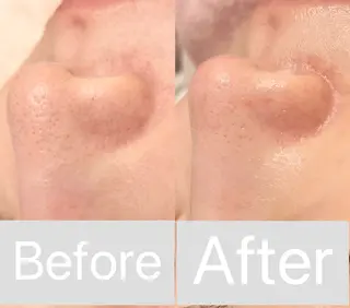 アイラッシュ&エステサロンLinda西宮所属・小顔&毛穴・肌質改善 LINDA西宮 AIのエステ・リラクイメージ