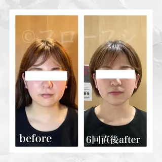 部分痩せ♥️小顔専門 MIKUのエステ・リラクイメージ