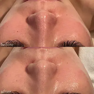 デ・アイム心斎橋所属・肌質改善サロン🫧 MAIのエステ・リラクイメージ