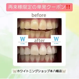 メンズ ホワイトニング ショップ本八幡店のエステ・リラクイメージ