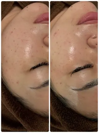 Moena.所属・Moena. 武蔵小杉🫧のエステ・リラクイメージ