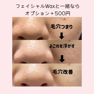 脱毛サロン KiWiのエステ・リラクイメージ