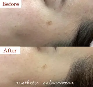 都度払い 肌質改善専門サロンのエステ・リラクイメージ