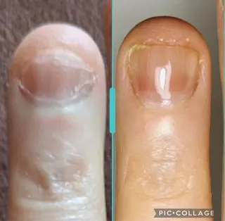 ネイル 深爪・自爪育成専門 MAHALOHIのネイルデザイン