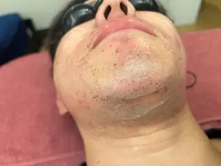 メンズ 脱毛サロンpremium所属・ラヴィアンローズ 田町のエステ・リラクイメージ