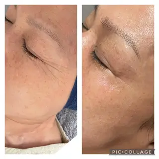 Raviliss ラヴィリスのエステ・リラクイメージ