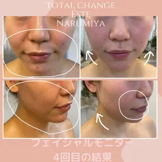 辻 佐耶のエステ・リラクイメージ