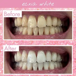 セルフホワイトニング エクシア大府店のその他イメージ