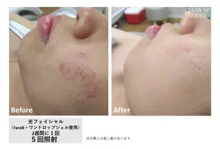 K しずくのエステ・リラクイメージ