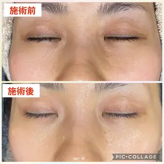 肌質改善プライベートサロンwith U所属・肌質改善サロン with Uのエステ・リラクイメージ