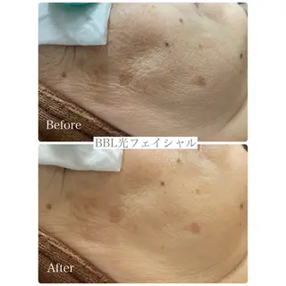 DISINI  SPA所属・DISINISPA 脱毛/フェイシャルのエステ・リラクイメージ