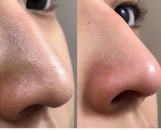 POLA   Avan Mu所属・下谷 葵のエステ・リラクイメージ