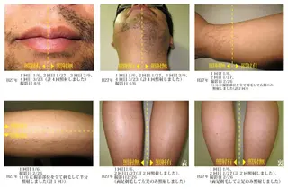 メンズ 脱毛＆エステサロン【アンリミット】所属・森谷 莉美のエステ・リラクイメージ