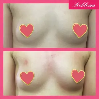 デリケートな悩み解決 Rebloomのエステ・リラクイメージ