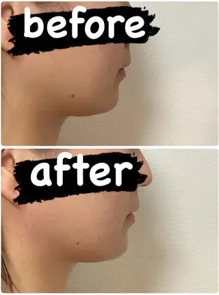 【痩身・脱毛サロン】 REBISKIN🌱のエステ・リラクイメージ