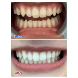 M渋谷店所属・Ｍ渋谷 ホワイトニングのエステ・リラクイメージ