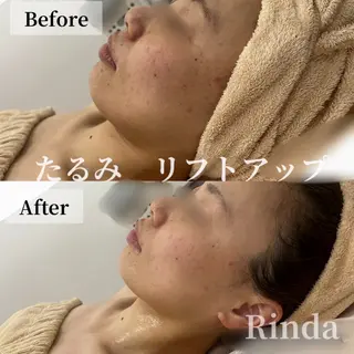 ブライダル痩身×脱毛 尼崎駅前サロンのエステ・リラクイメージ