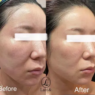 Lavi&所属・肌質改善サロン Lavi&のその他イメージ