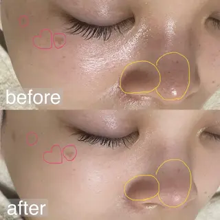 アイブロウ&フェイシャルサロンa‘lm所属・WAX脱毛/肌質改善 眉毛とお肌のサロンのエステ・リラクイメージ