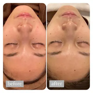 美肌脱毛専門サロン Dione栄店のエステ・リラクイメージ