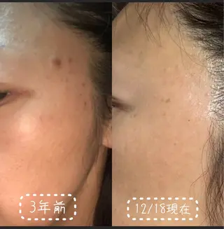 透明感の肌Lino malieのエステ・リラクイメージ