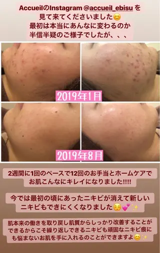 ミディアム カラー パーマ ヘアアレンジ メンズ キッズ ネイル マツエク・マツパ ニキビ・肌質改善専門 ♡人生が変わるサロンのエステ・リラクイメージ