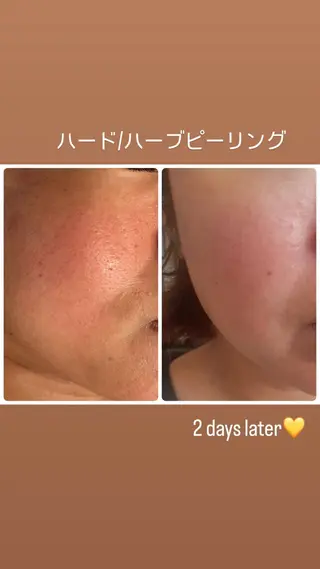 yellow.所属・yellow💛【 脱毛&フェイシャル】のエステ・リラクイメージ