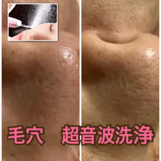 フェイシャルワックス 自然派エステファーノのその他イメージ