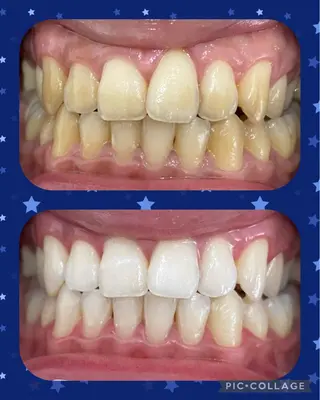 DIA WHITE 奥田のその他イメージ