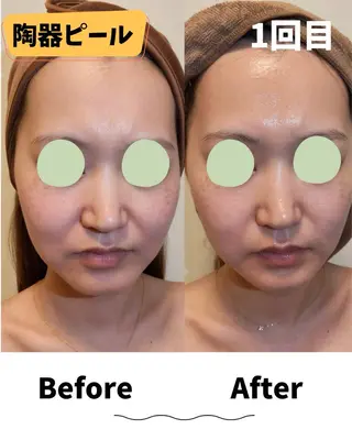 コンセプトサロン友 木下のエステ・リラクイメージ