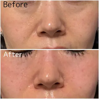 【敏感肌管理×小顔サロン】Belle orchid所属・敏感肌×小顔サロン 玲央奈のエステ・リラクイメージ