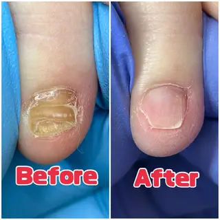 巻き爪補正店　柏店所属・巻き爪補正店 柏店のその他イメージ