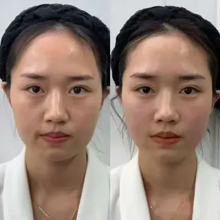 ショート aliaハイフ&水光ジェットサロン所属・aliaハーブ水光店 エステティシャン募集のエステ・リラクイメージ