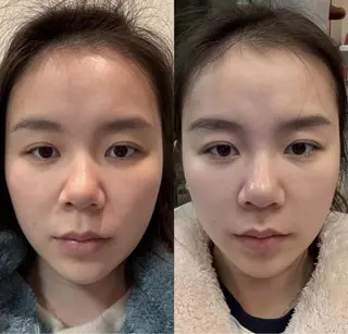 ネイル aliaハイフ&水光ジェットサロン所属・aliaハーブ水光店 エステティシャン募集のエステ・リラクイメージ