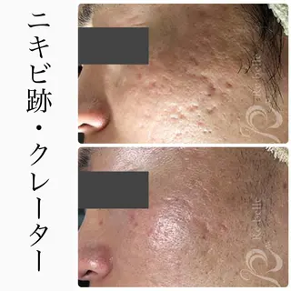 ハーブピーリング専門 BIOEL横浜のエステ・リラクイメージ