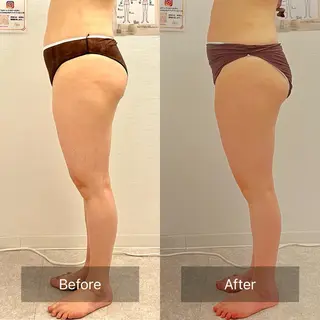 salon ray 痩身/体質改善のエステ・リラクイメージ