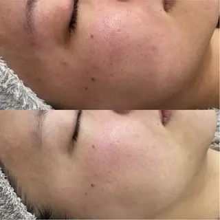 CE salon Euluna所属・CE salon Eulunaのエステ・リラクイメージ