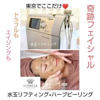 【ニキビ/肌管理】 salon varyのエステ・リラクイメージ