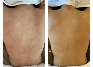 肌質改善 KALANCHOEのエステ・リラクイメージ