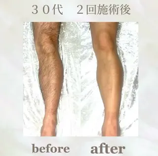 LED脱毛サロン【the 4】所属・元町駅1分 メンズ脱毛サロンのエステ・リラクイメージ