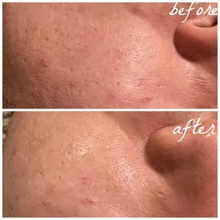 メンズ メナード岐阜市茜部 杉浦のエステ・リラクイメージ