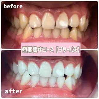 メンズ ホワイトニングサロン BE WHITE金山のその他イメージ