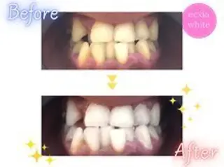 セルフホワイトニング エクシア西宮北口店所属・セルフホワイトニング エクシア西宮北口店のその他イメージ