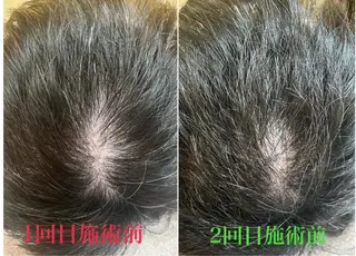 アロマ･美容鍼･カッ ピング「麗」鍼灸院のエステ・リラクイメージ