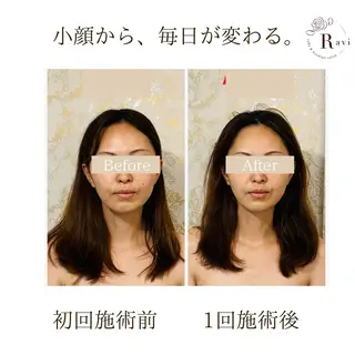 小顔サロンラヴィ　　船橋馬込沢店所属・小顔サロンラヴィ 船橋のエステ・リラクイメージ