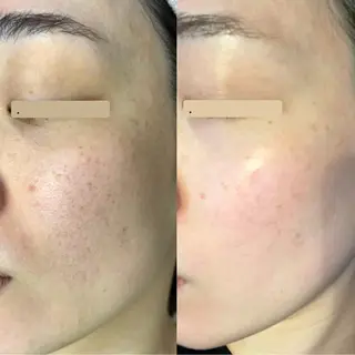 カムイ所属・カムイ 山﨑のエステ・リラクイメージ