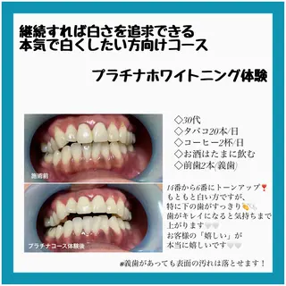 ネイル/耳つぼ /新ホワイトニングのネイルデザイン