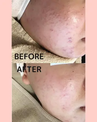 Rapport所属・Rapport ラポールのエステ・リラクイメージ