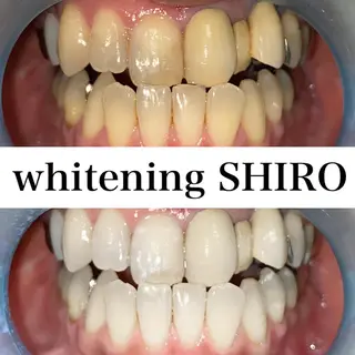 福岡ホワイトニング SHIRO天神店のエステ・リラクイメージ